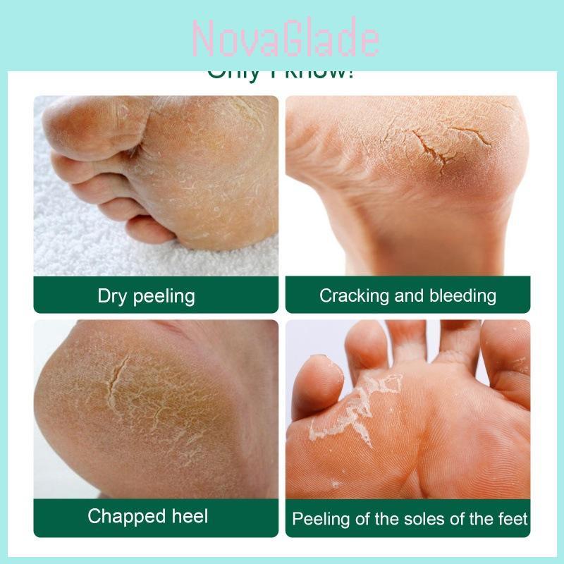 Ouhoe Nourishing Foot Repair Cream For Cracked Heels Dry Skin And Hydration 100g