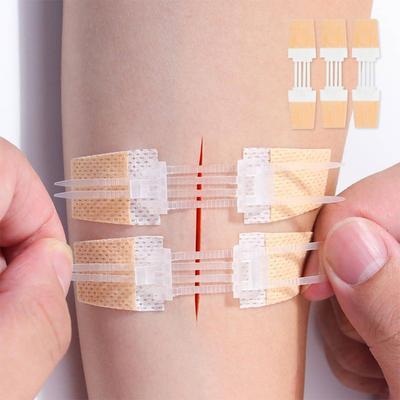 Tira Elástica Médica Estilo Zíper Fita Adesiva Reversível Retorno e Atualização Fita Sem Costura Curativo para Ferida na Pele Lesão Prático