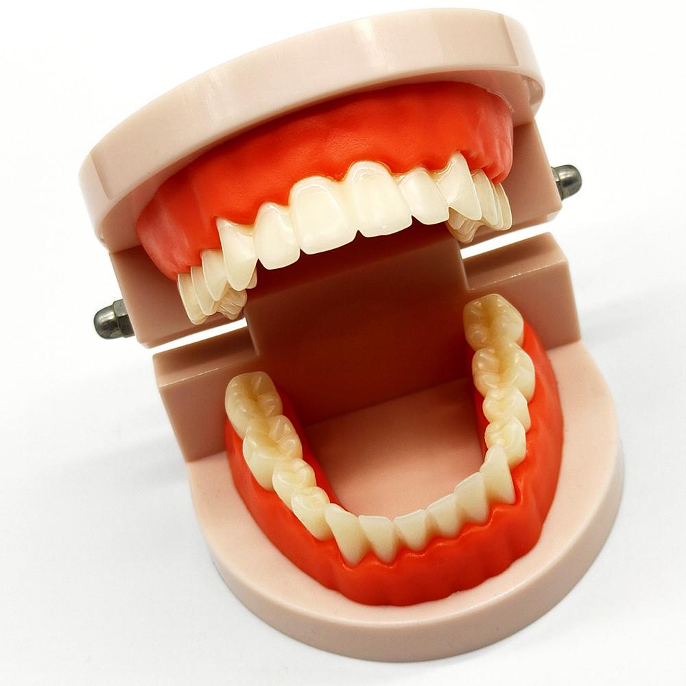 1 Piece Dental Tooth Model Standard Teeth Model Dental Caries Model for Patient Communication Dentist Study Model with Decayed Tooth