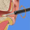 Children's ear scoop, ear scoop, wireless cleaning endoscope, high-definition ear picking