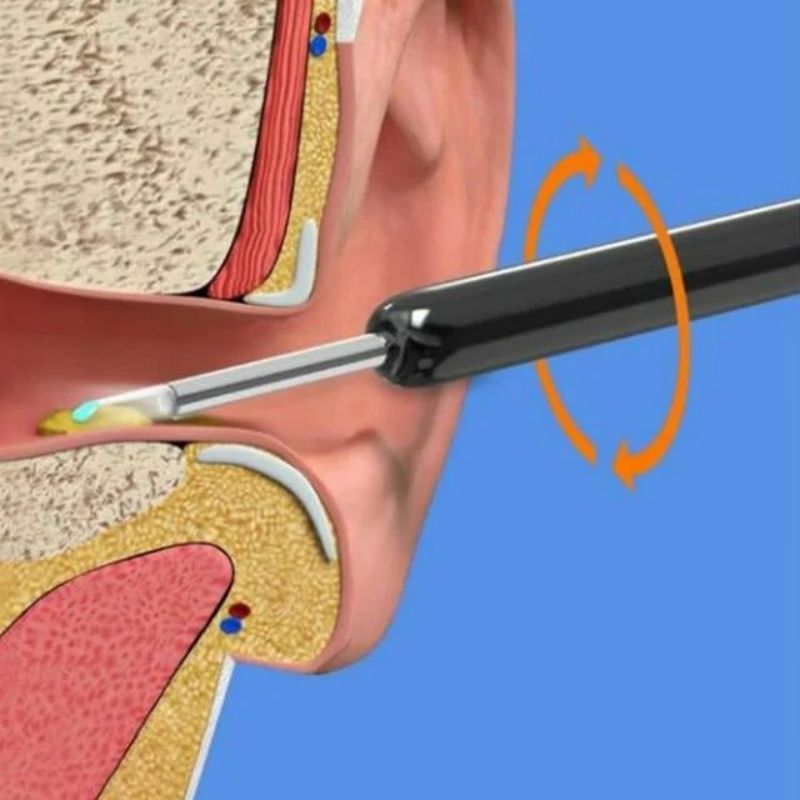 Children's ear scoop, ear scoop, wireless cleaning endoscope, high-definition ear picking