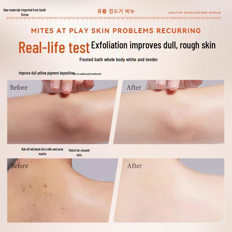 SEEDONVEUR Sulfur Mite Removal Scrub Shower Gel