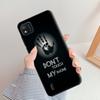 For Wiko Y62 Plus Case Fashion Protective Phone Cases Y 62 Back Cover for Wko Y81 Y82 WikoY62 Silicone Cute Bumper Y62Plus Funda