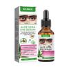 Anti Dark Circle Serum Pigment Correction Remove Puffiness Eyes Bag Moisturize Hydrating Nourish Aloe Vera Whitening Eye Essence
