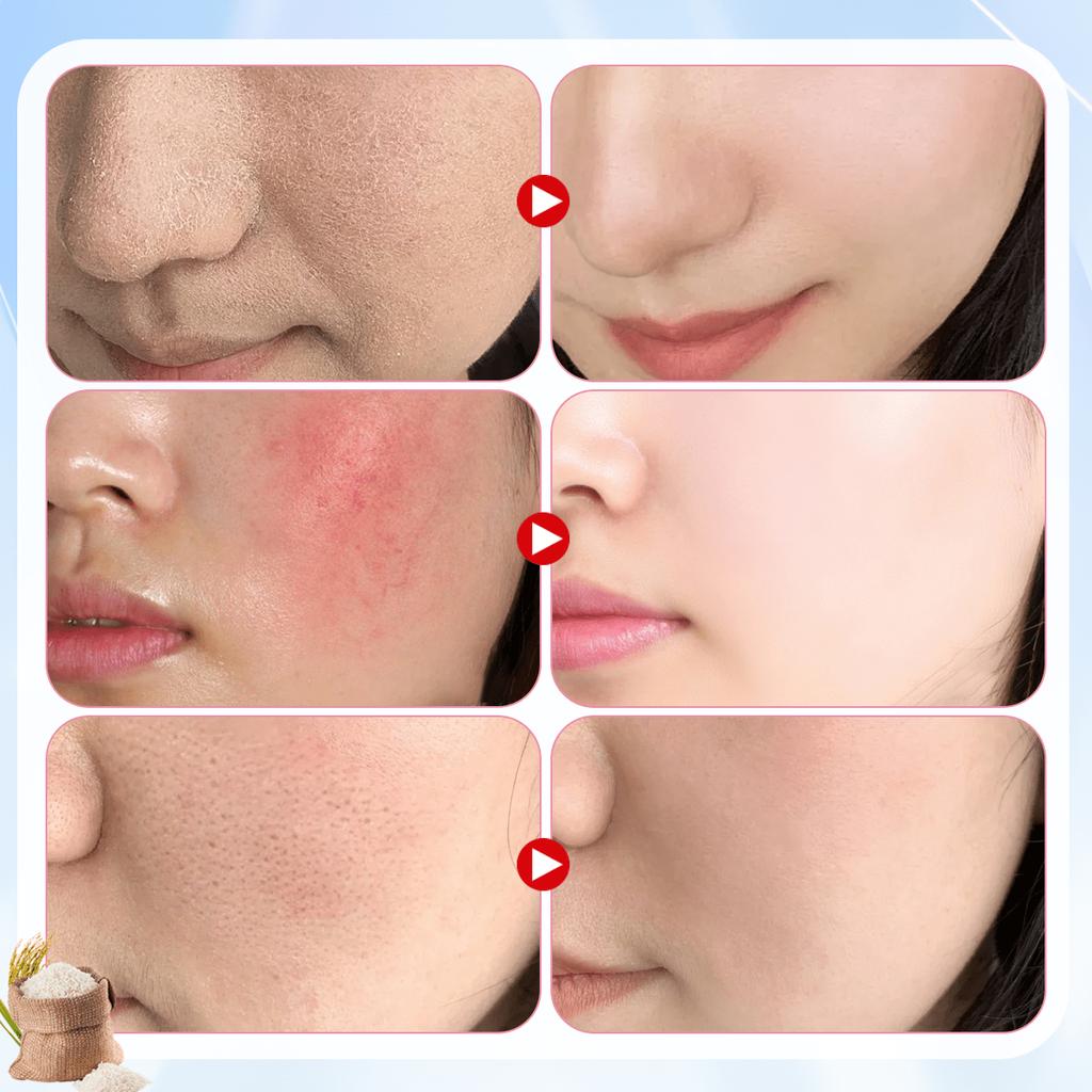 1/2pcs 70% Rice Essence Whitening Face Cream, Essence Anti Wrinkle Firming Cream, 50g, Containing Ni