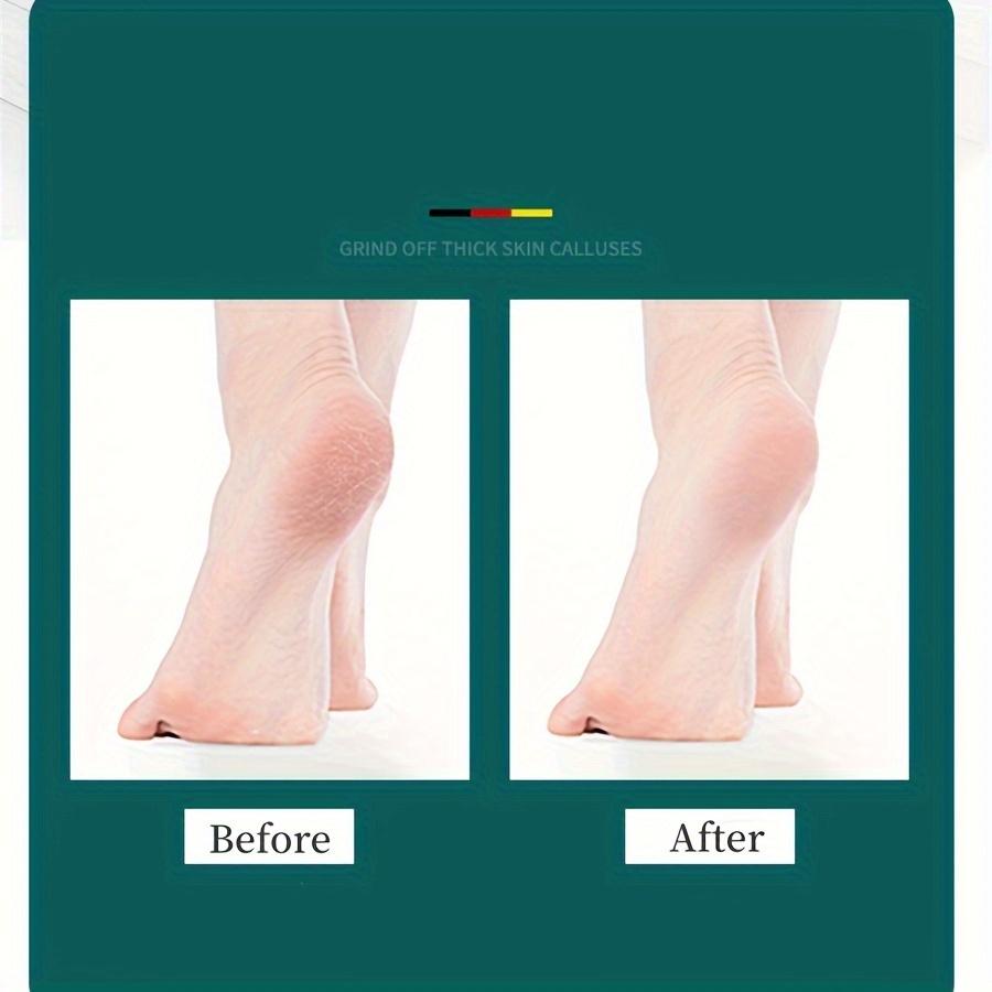 High Quality Foot File Double Sided Callus Remover For Dead Skin Professional Pedicure Tools Callous Scraper Sander Heel Filer