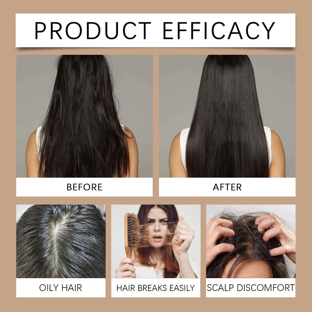 Natural Hair Growth Shampoo Promotes Hair Growth And Cleanses The Scalp,100ml