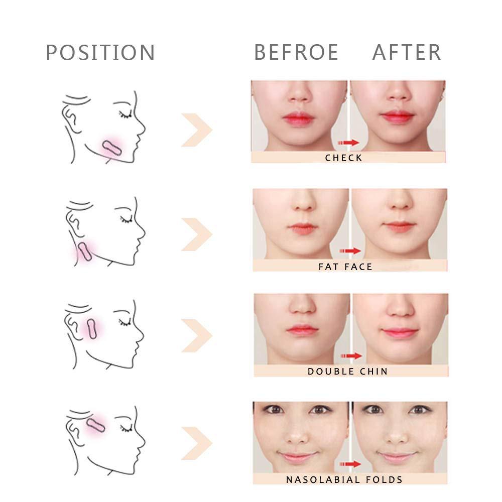 Korean Slimming Face Lifting Tape: Invisible V Face Tightening Bandage