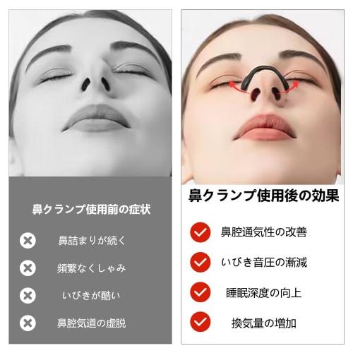 Anti-Snoring Device [Recommended by Sleep Experts] Snoring Prevention Nasal Breathing Clip, Nostril Dilation, Mouth Breathing Prevention Tape, Nasal B