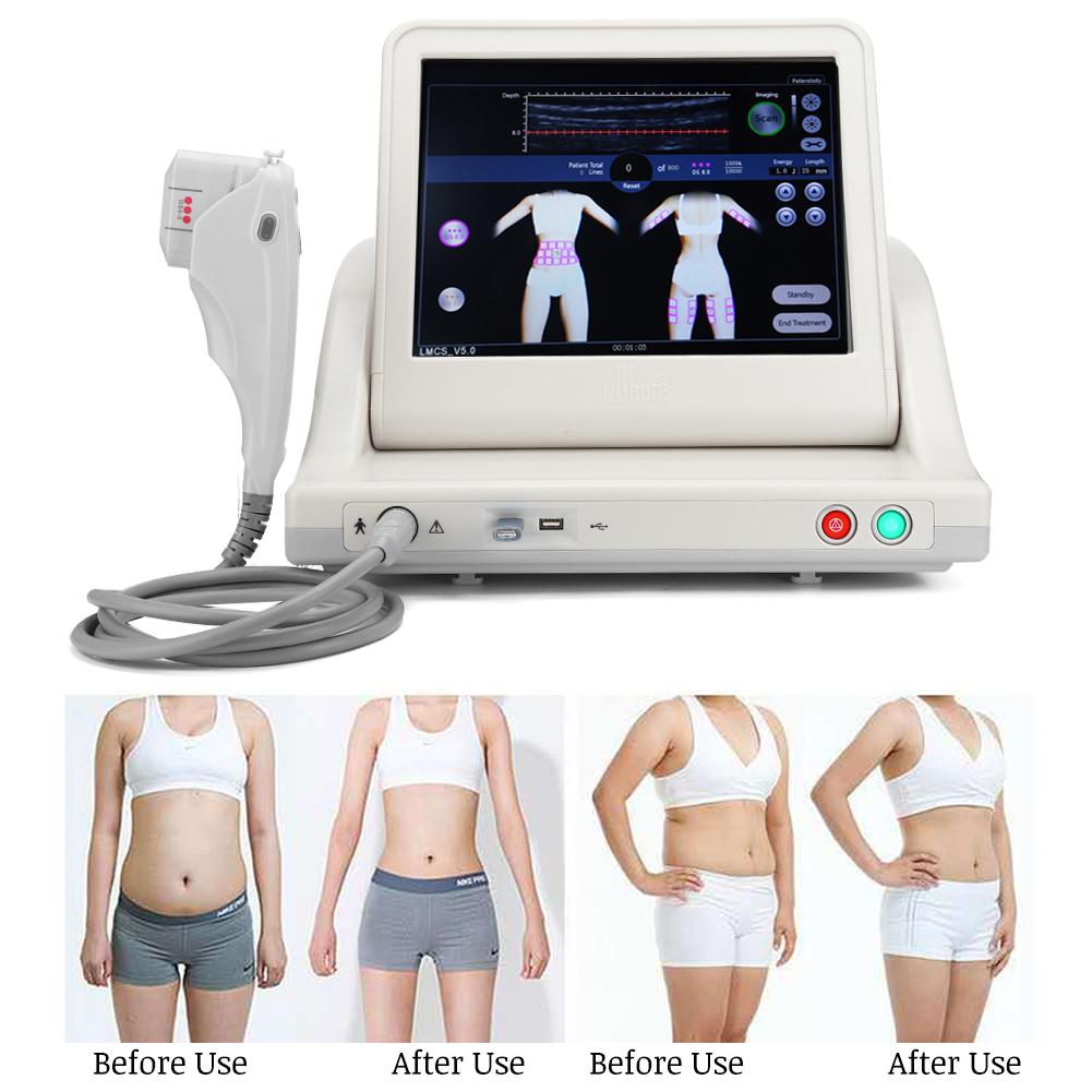 5in1 Ultrasound Anti Aging Wrinkle Removal Body Slimming Facial Beauty Machine