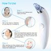 Blackhead Vacuum Remover, Powerful Portable Facial Pore Cleaner With 4 Probes, Remove Blackhead In Gentle And Safe Way