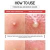 Elizavecca - Witch Piggy Hell Pore Blemish Spot Patch
