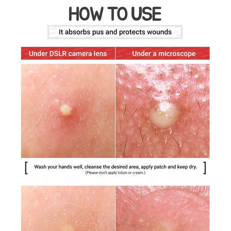 Elizavecca - Witch Piggy Hell Pore Blemish Spot Patch