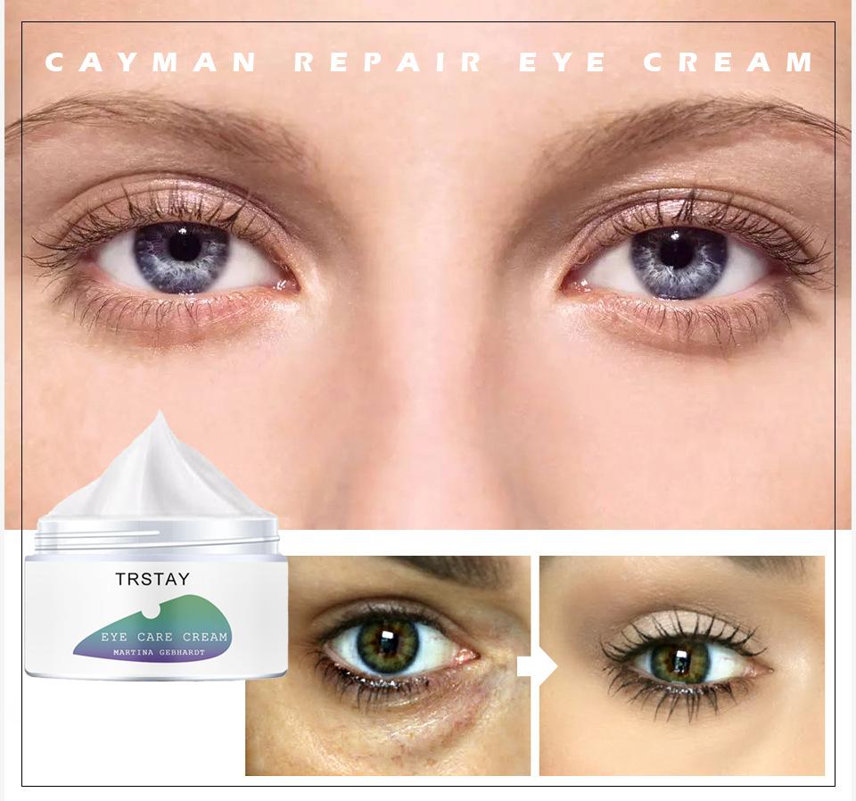 Firming Moisturizer Eye Cream Hyaluronic Acid Eliminates Dark Circles and Wrinkles Natural Moisturizing Factors Hydrate and Moisturize