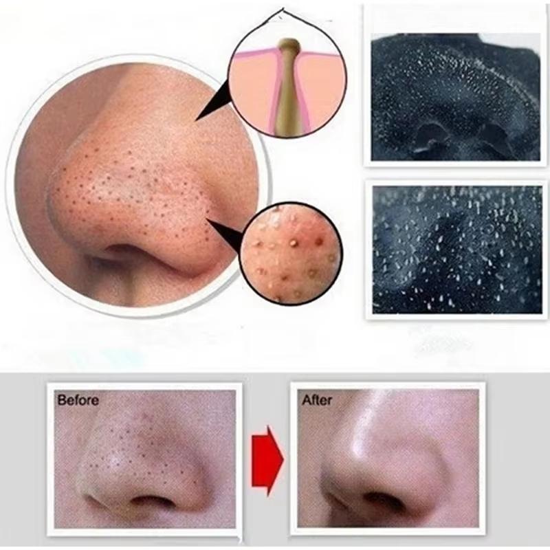 Masque anti-points noirs au charbon de bambou, rétrécit les pores, élimine l'acné et les points noirs, nettoie le nez, masque peel-off noir, soin de la peau