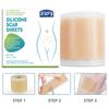 1PC 150CM Silicone Gel Scar Sheet Patch Treatment Removal Tape Acne Trauma Burn Scar Cover Skin Repair Section Ear Beauty