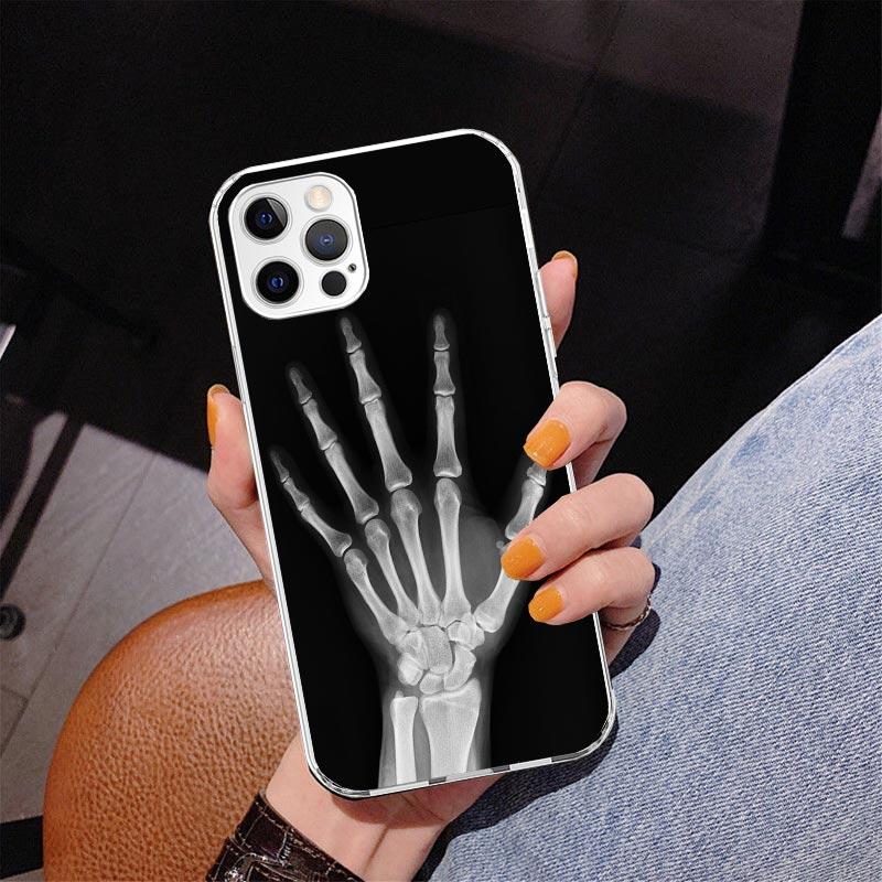 Autumu X Ray Hand Bones Phnoe Case for Iphone 17 Air 16 16E 11 12 13 Mini 14 Plus 15 Pro Max 7 8 + SE 2020 Phone Cover Coque