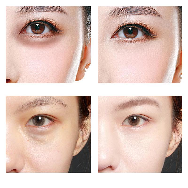 Zuoxiang 24K Gold Caviar Eye Patch: Hydrating & Moisturizing Eye Care.