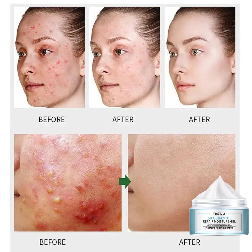 Retinol Moisturizing Face Cream, Mild and Non Irritating, Moisturizes, Brightens Skin Tone, and Makes Skin Soft and Delicate