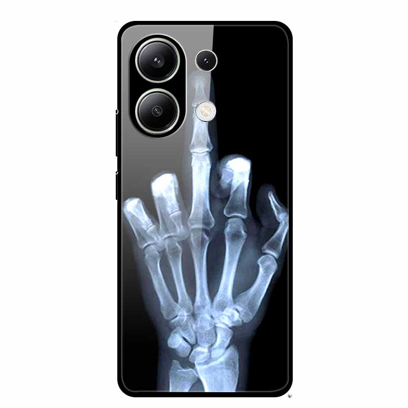 For Xiaomi Redmi Note 13 Pro 4G 6.67"Tempered Glass Cases Silicone Bumper Hard Back Covers for Redmi Note13 4G 6.67" Phone Cases