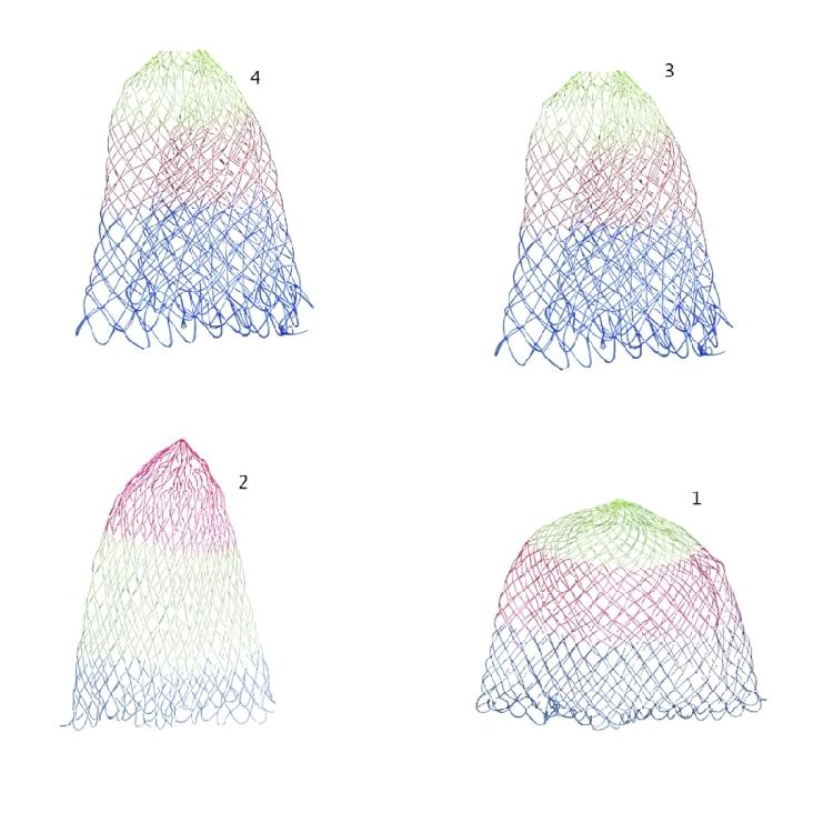 Outdoor Fishing Net Folding Landing Dip Net for Freshwaters and Saltwater