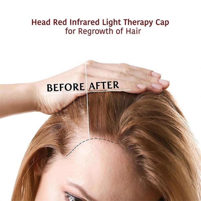 Infrarot-Haarwachstumskappe Infrarot-Haarwachstumsgerät Rot- und Blaulicht-Haarwachstumskappe Laser-Haarwachstumsgerät Haarpflegegerät