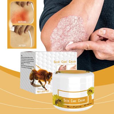 Bee Skin Relieving Cream Soothes Discomfort, Nourishes Skin, Improves Skin Condition, Cream