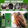 120ml Thailand Neo Hair Lotion Serum Essence Anti Hair Loss Treatment Hair Beard Growth For Men Women  Spray Oil Kit