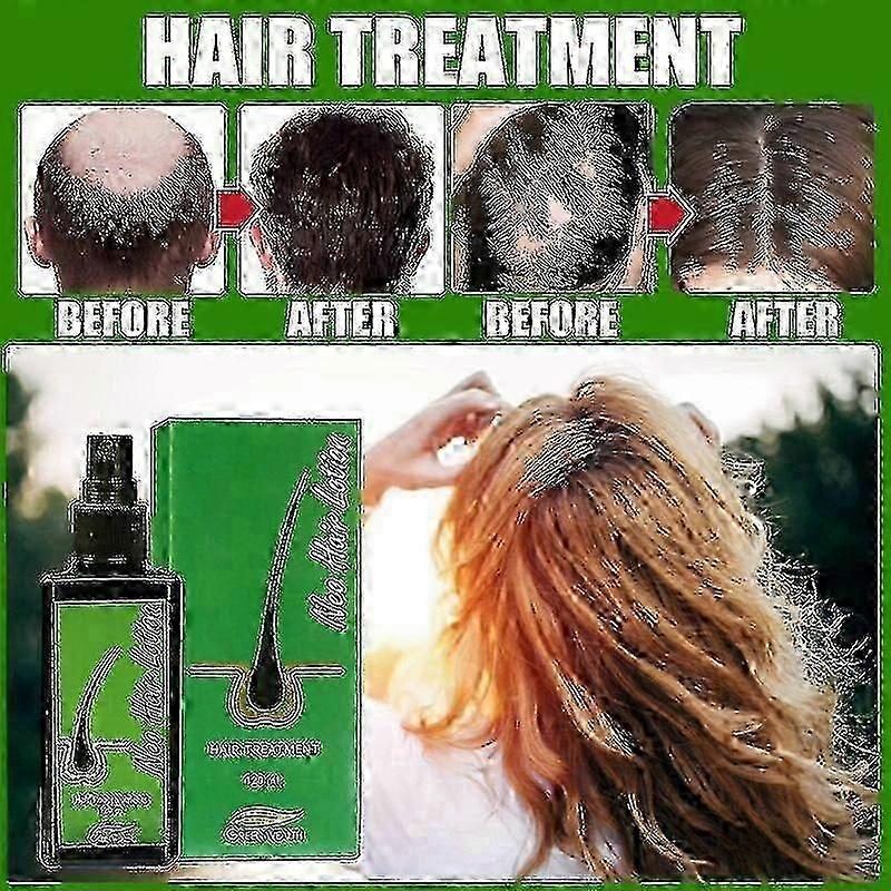 120ml Thailand Neo Hair Lotion Serum Essence Anti Hair Loss Treatment Hair Beard Growth For Men Women  Spray Oil Kit