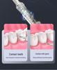 Portable Ultrasonic Water Flosser and Tooth Cleaner