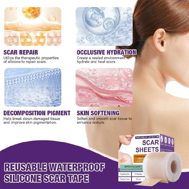 Flexible Silicone Scar Patches 4X150CM Scar Management Portable Scar Sheets for Adults Skin Repair Solution