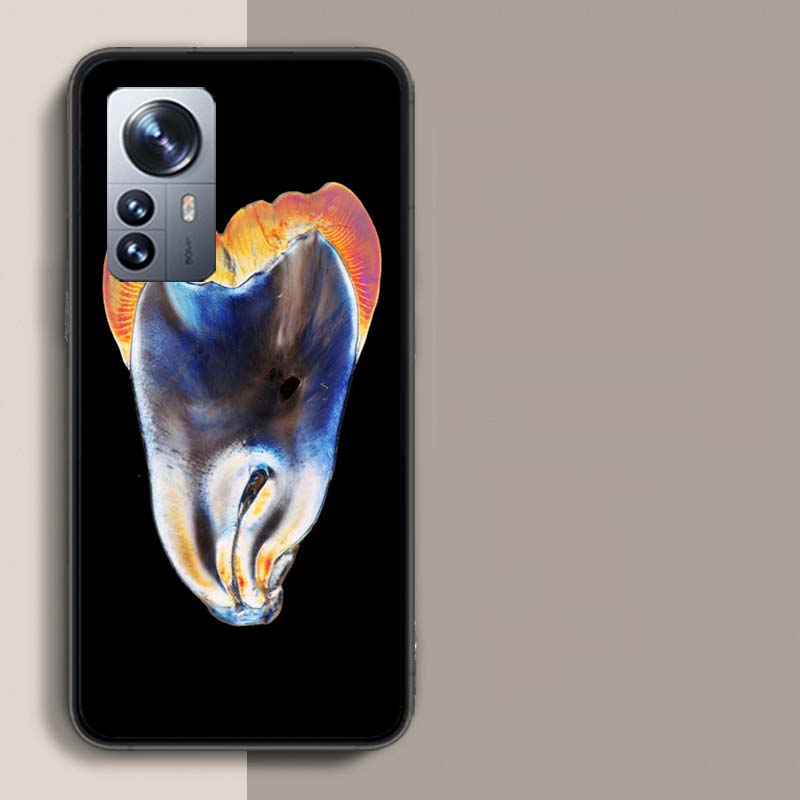 Dentist Tooth Pattern Phone Case For Xiaomi Poco X3 NFC X4 GT M3 M4 M5 M5S X7 X6 X5 F6 Pro F5 F4 Mi F3 F2 Cover TPU Capa Coque C