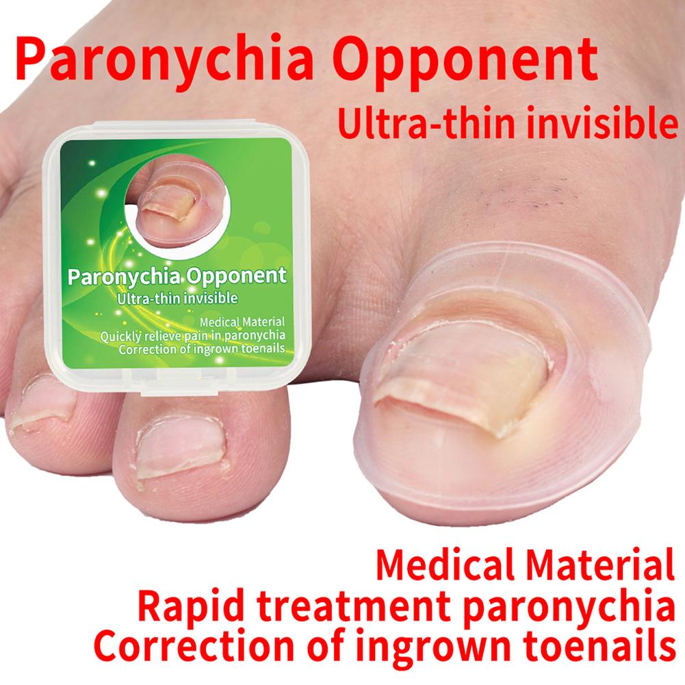 2pcs Silicone Ingrown Toenail Correcting Tool Pain Relief Paronychia Treatment Corrector