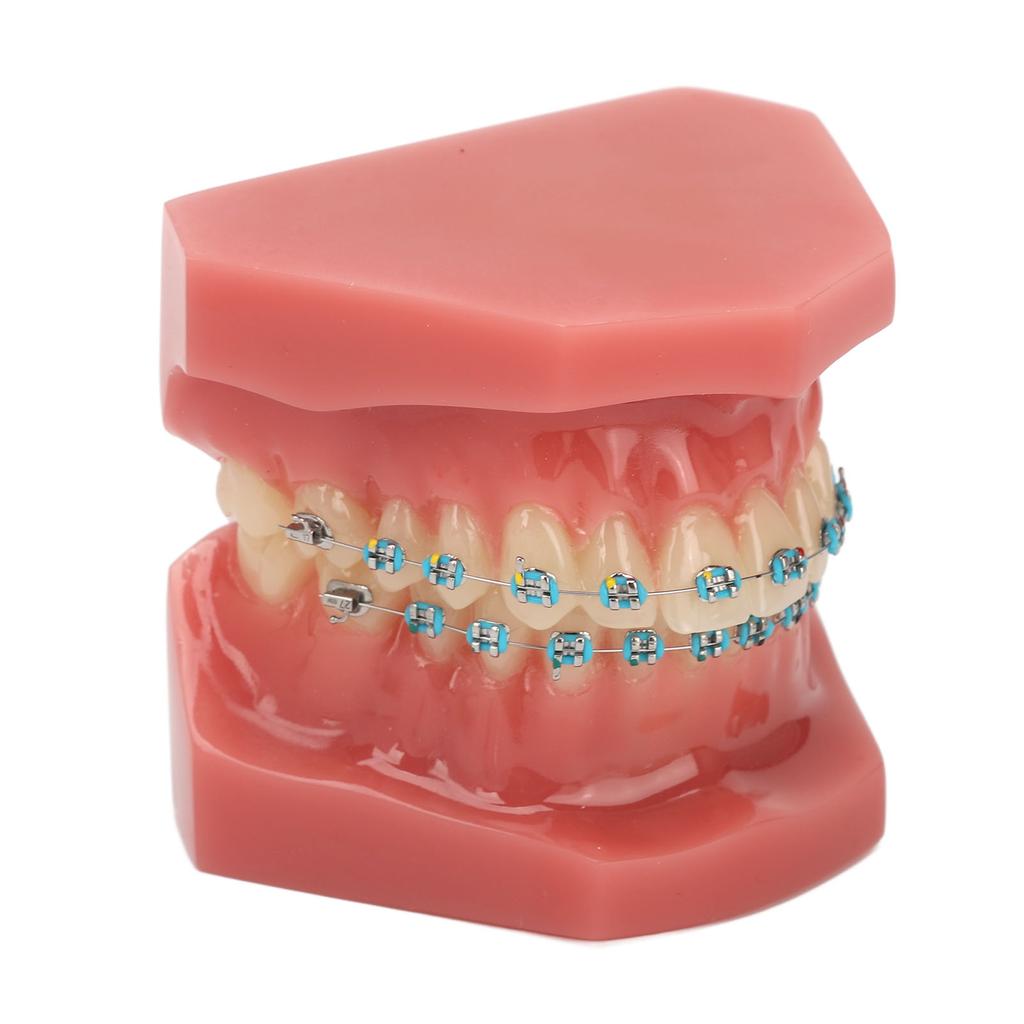 Zahnärztliches Kieferorthopädisches Modell 28 Zähne Harz Zahnärztliches Lehrmodell Zähne mit Metallbrackets