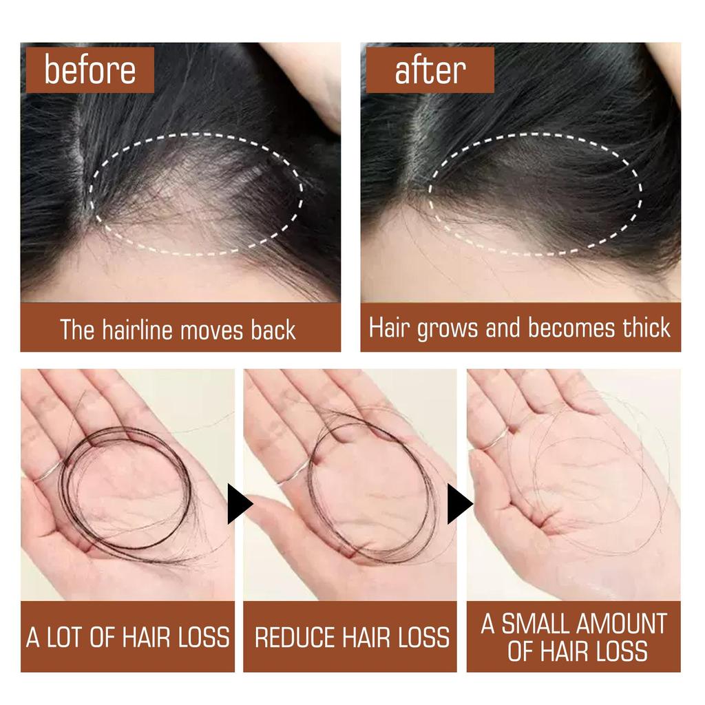 Balsamo per Capelli all'Olio di Batana Migliora i Capelli Secchi e Crespi Lisci Morbidi Spessi Idrata e Nutre il Cuoio Capelluto Prodotto per la Cura dei Capelli