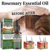 3x EELHOE Hair Oil For Dry Scalp Stimulates Hair Growth Hair Care Essential Oil Refreshing Firming Skin Rosemary Oil