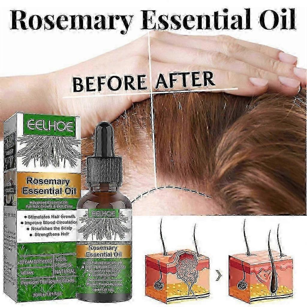 3x EELHOE Hair Oil For Dry Scalp Stimulates Hair Growth Hair Care Essential Oil Refreshing Firming Skin Rosemary Oil