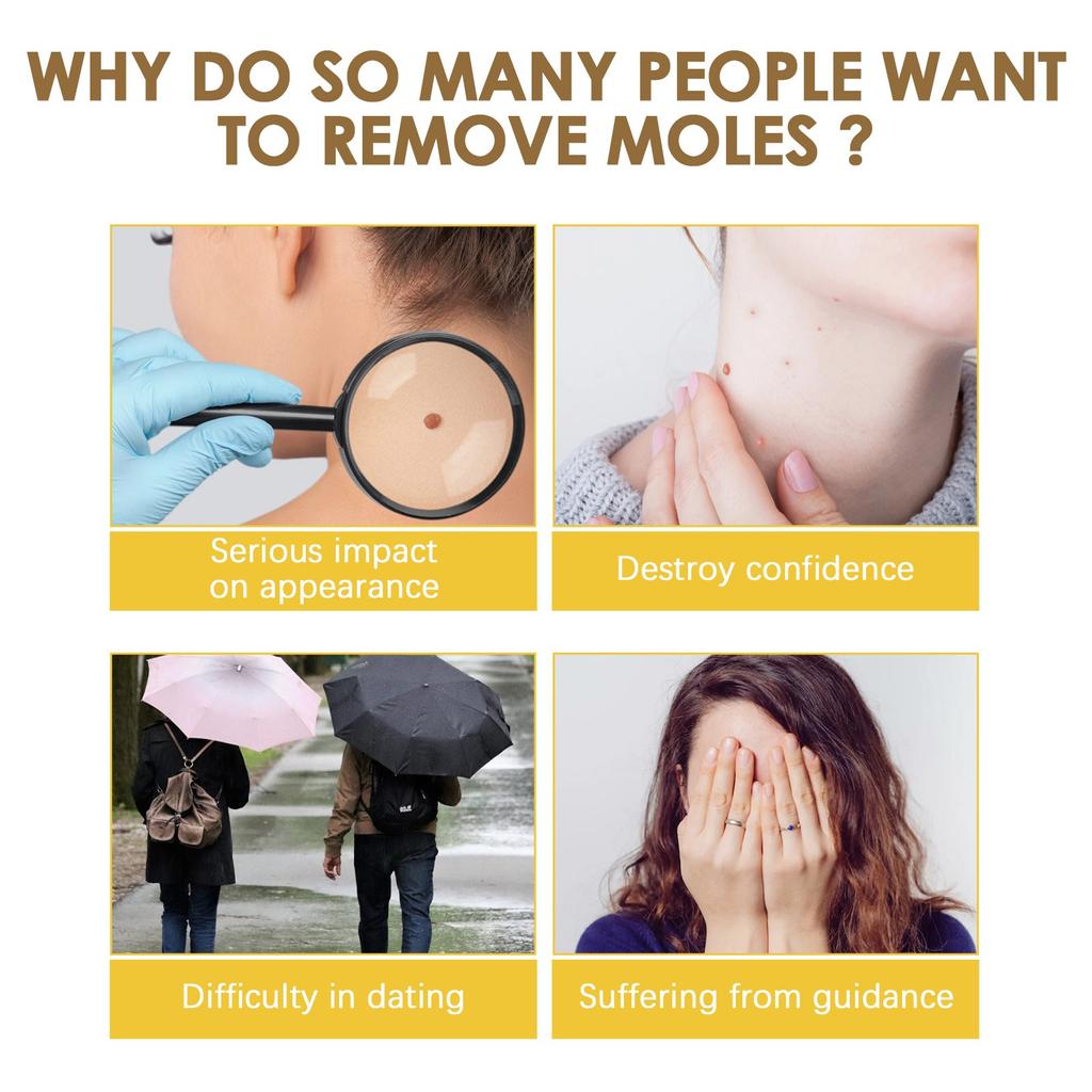 Bee Relief Ointment, Bee  Gel, And Bee  Can Remove Skin Pimples Without Irritation Or Traces,20ML