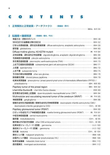 Easy-to-understand Brain MRI, Revised 4th Edition (Image Diagnosis Special Edition KEY BOOK Series)