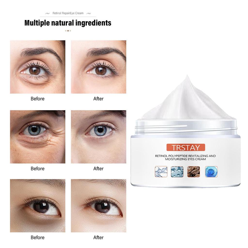 Intensive Eye Cream For Wrinkle Reduction And Deep Moisturization