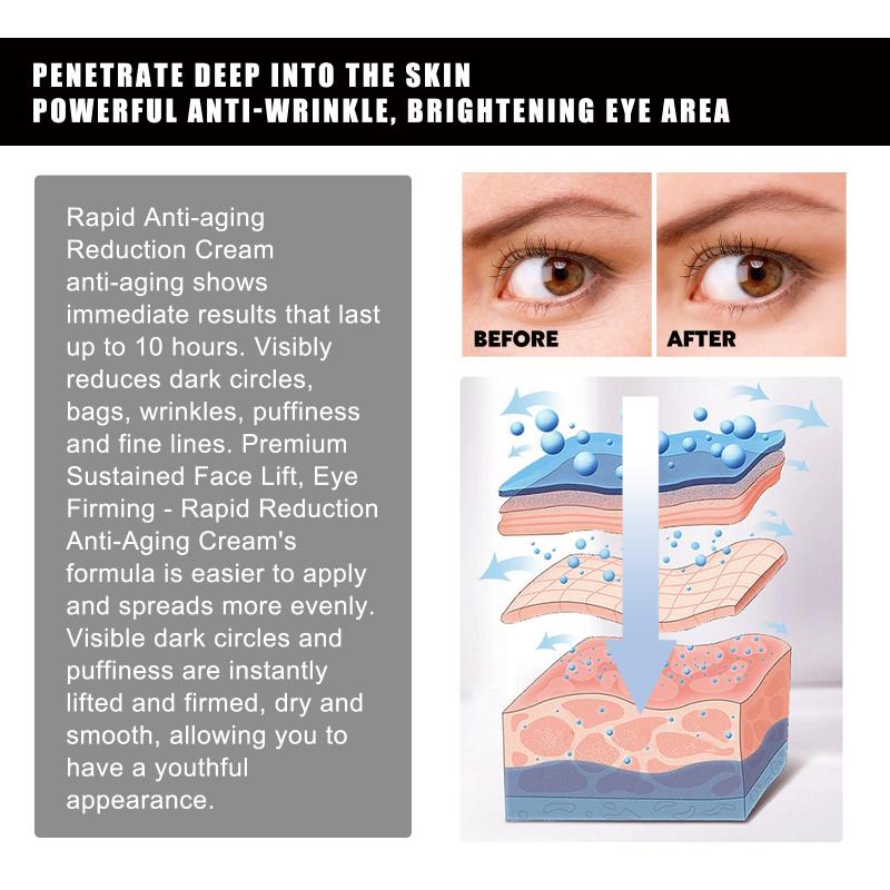 Strawberry Eye Gel Patches Reduce Fine Lines Dark Circles Puffiness Tighten Skin Anti Wrinkle Moisturizing 60 Pairs