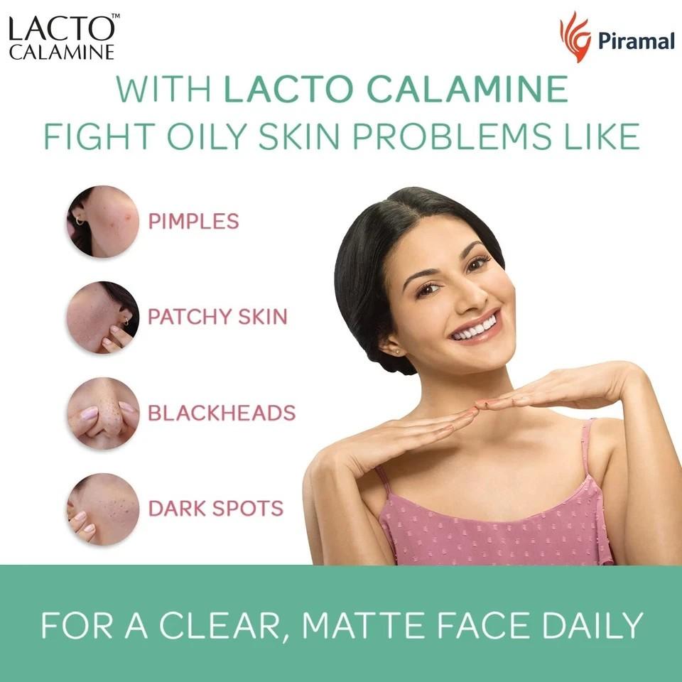 Lacto Calamine Gesichtscreme Ölregulierend Für Normale Und Mischhaut 60ml