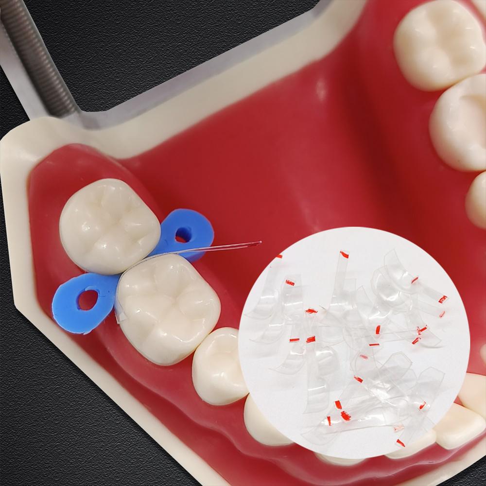 Dental Transparent Sectional Contoured Matrices Matrix Polyester Matrice  for Anterior and Posterior Teeth