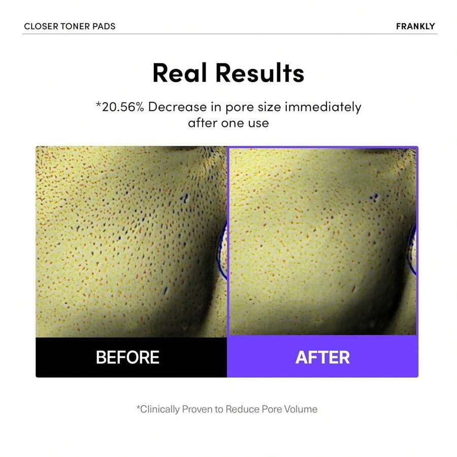 FRANKLY Pore Closer Toner Pads 105ml(70ea) L Rice Jelly Pads With 9 Peptides, Vegan Collagen, Rice Extract L Pore Minimizer