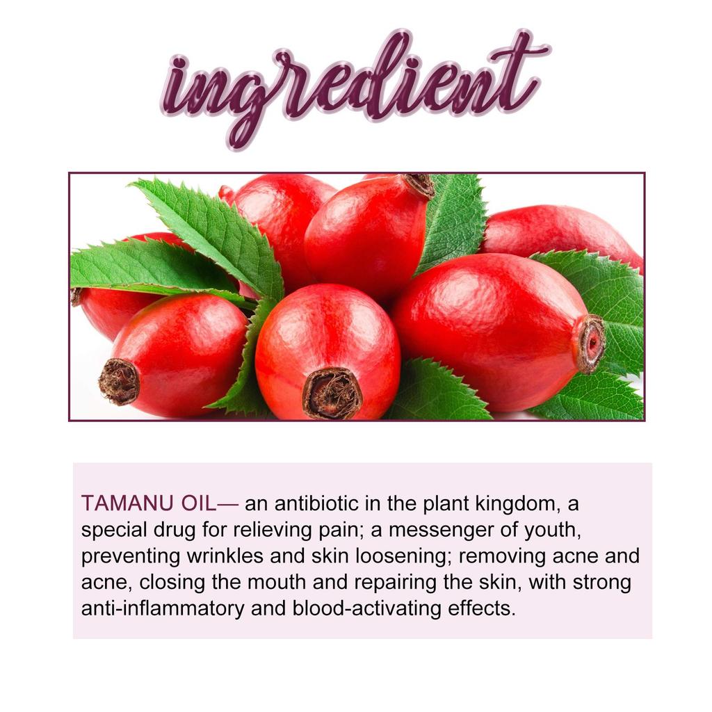 EELHOE Begonia Facial Oil Fades Acne Marks, Lightens Lines, Moisturizes & Firms Skin Essential Oil