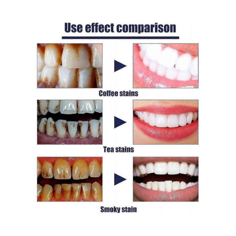 Whitening Toothpaste, Teeth Whitening Paste, Sparkly White Herbal Toothpaste for Smokers, Fresh Breath, Remove Yellow Tooth Stains, Deep Cleaning