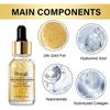 Hoygi 24K Gold Niacinamide Serum - Lightens Spots And Fine Lines, Repairs Dull Skin, Brightens And Smooths Skin