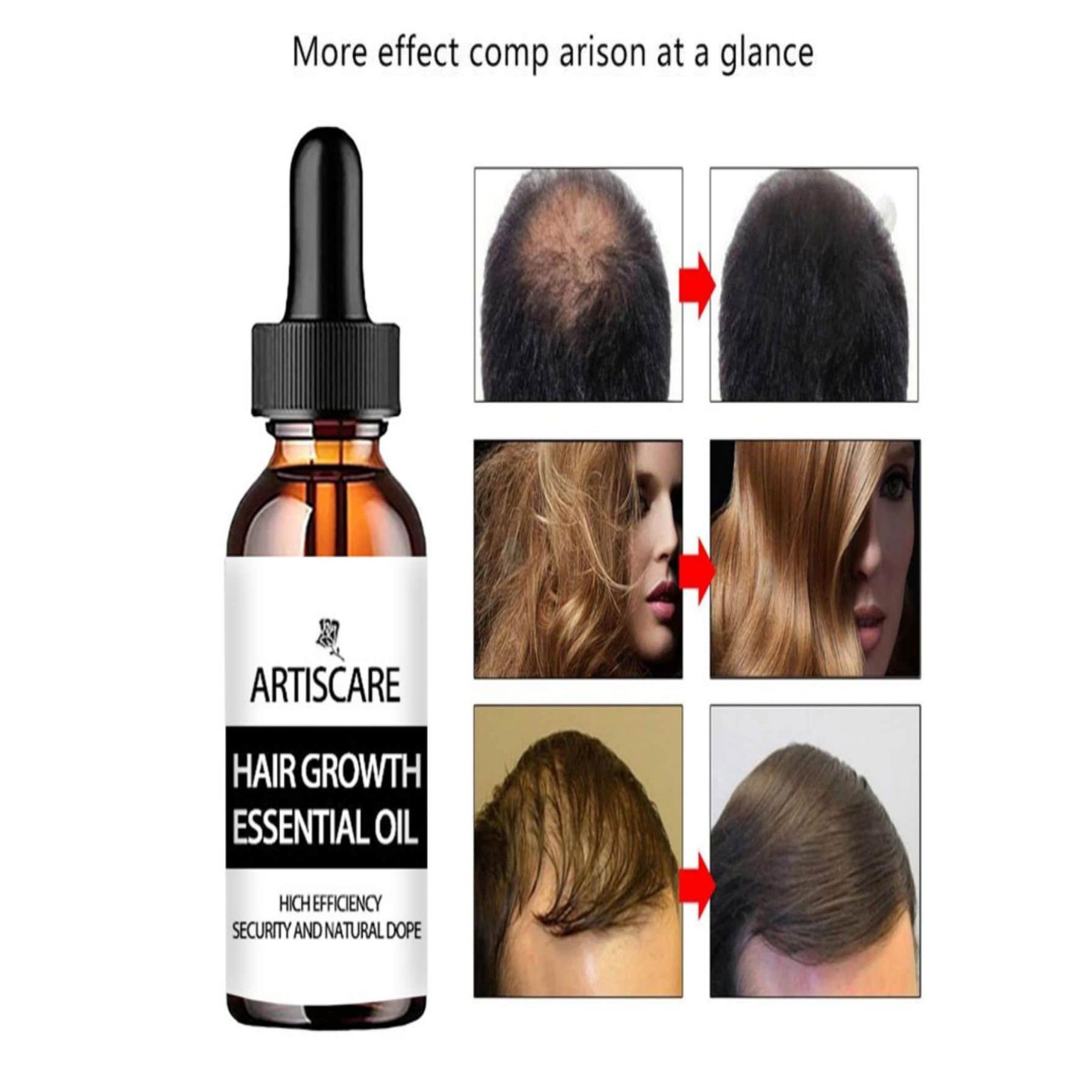 

5 мл/15 мл/30 мл/50 мл/имбирные эфирные масла для роста волос, средства против выпадения волос, быстрорастущая зародышевая сыворотка, предотвращающая повреждение кожи головы для мужчин и женщин