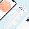 Multi Speed Pore Vacuum Cleaning Blackhead Remover For Face With Intelligent Suction Control And Reusable Tips
