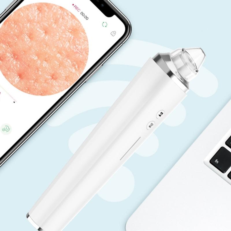 Multi Speed Pore Vacuum Cleaning Blackhead Remover For Face With Intelligent Suction Control And Reusable Tips